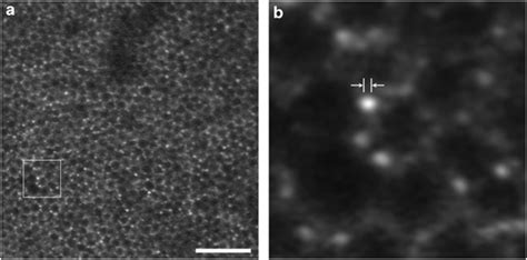 Retinal pigment epithelium and individual lipofuscin granules revealed ...