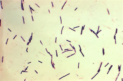 Clostridium perfringens – Fundación io