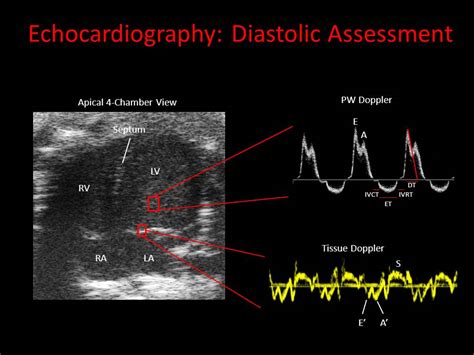 Echocardiography | Phenotyping Core