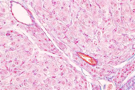 Histological Ovary, Testis and Sperm Human Cells Under Microscope ...