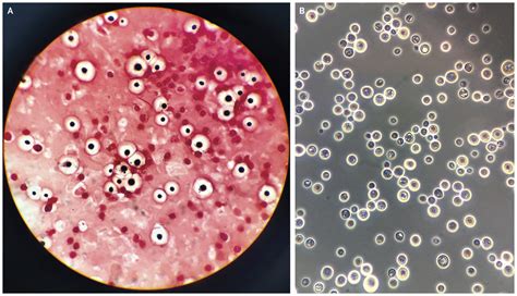 Cryptococcus neoformans - EcuRed