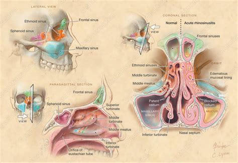 Medical and Scientific Illustration || Portfolio | Paranasal sinuses ...