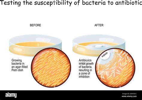 Antibiotic bacteria petri dish Stock Vector Images - Alamy