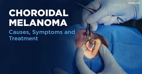 What Are the Symptoms of Choroidal Melanoma?