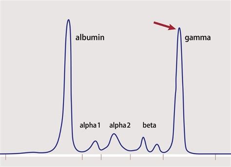 What is a serum protein electrophoresis (SPEP)? • The Blood Project