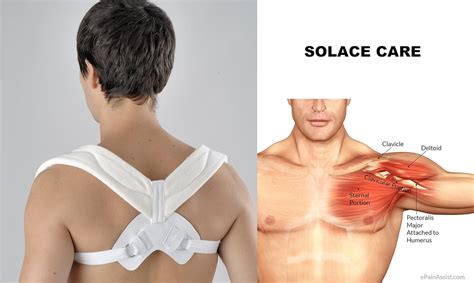 Adjustable Clavicle Posture Support for Collar-bone Injury - Clavicle AID Brace Weak Scapula ...