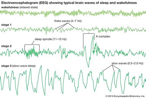 K-complex | sleep | Britannica