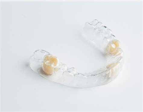 Essix Partial Denture Retainer – Dental Lab Direct