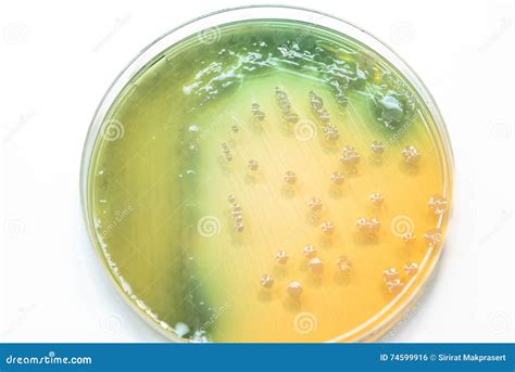 Bacterial Colonies Culture Growth On MacConkey Agar. Stock Photo ...