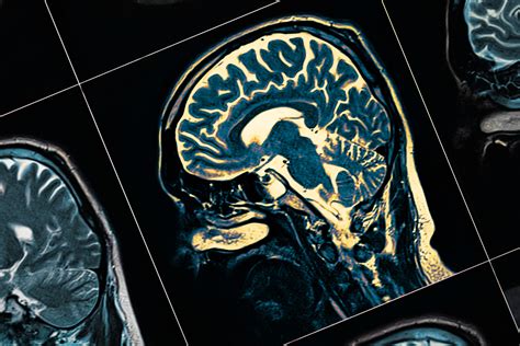 Large-scale analysis links glucose metabolism proteins in the brain to ...