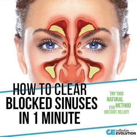 Top Home Remedies for Cleaning Ears | How to clear sinuses, Sinusitis, Blocked sinuses