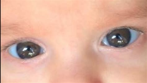 Hazel Eyed Babies? - BabyCenter