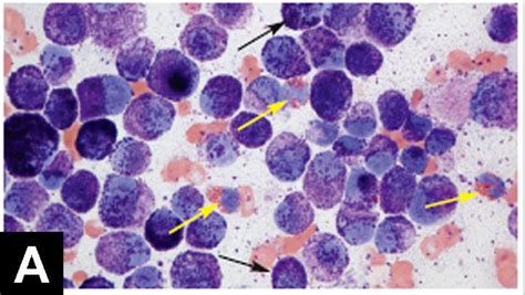 Top 5 Masses Diagnosed with In-House Cytology | Clinician's Brief Mast ...