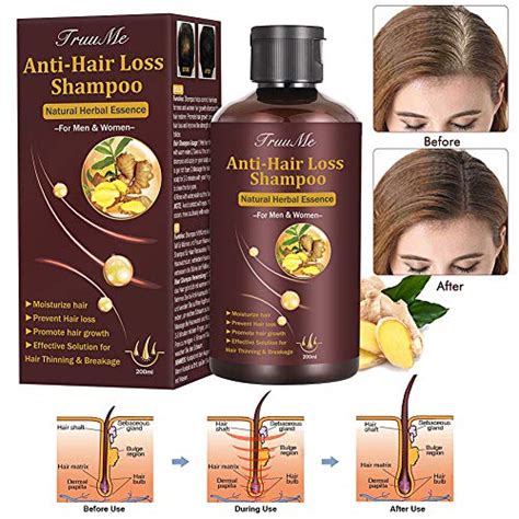 Hair Growth Shampoo,Hair Loss shampoo, Anti-Hair Loss Shampoo, Helps ...