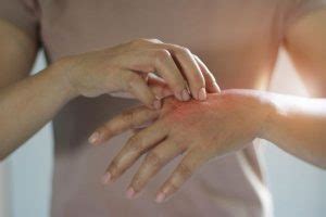 Degloving Injuries: Symptoms, Causes, Treatment - Maison Law