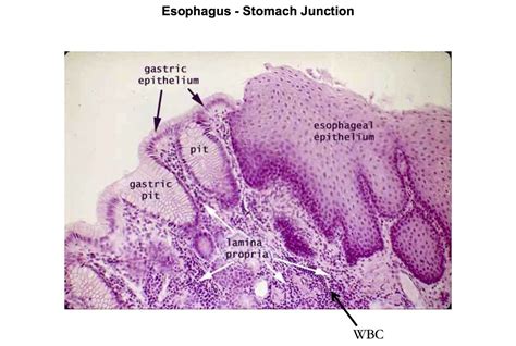 Esophagus - Stomach Epithelial Junction - Histology | Histología ️ ...