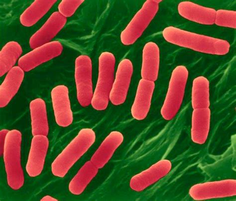 E. coli O157:H7, Escherichia coli - Expert Witness and Epidemiology ...