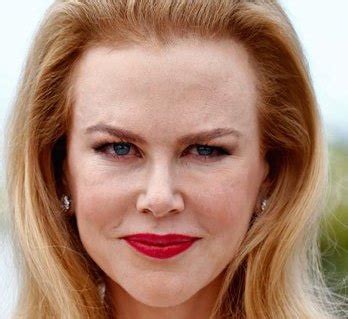 nicole kidman botox – TheCount.com