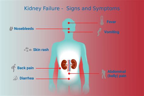 Signs and Symptoms of Kidney Failure - Ayurvedic Kidney Failure Treatment