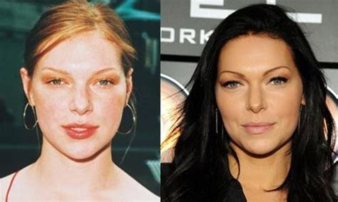 Laura Prepon before and after plastic surgery 3 – Celebrity plastic ...