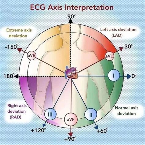 ECG Axis Interpretation - MEDizzy