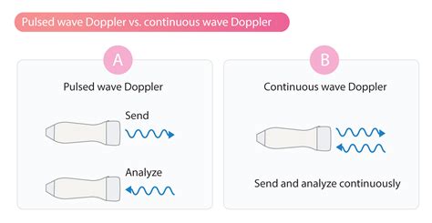 Continuous Wave Doppler (CW Doppler) – Cardiovascular Education