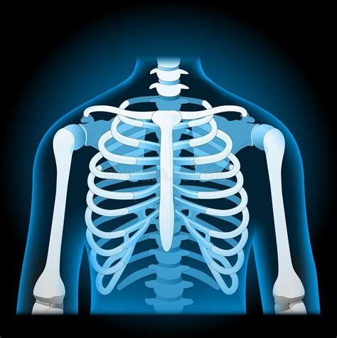 Human Rib Cage. X-ray Blue Realistic Torso Stock Vector - Illustration of poster, cage: 241061069