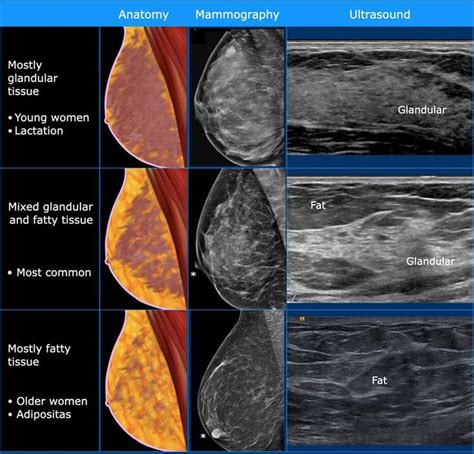 Ultrasound, Radiology imaging, Ultrasound sonography