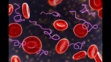 LIVE BLOOD ANALYSIS: ECHINOCYTES - YouTube