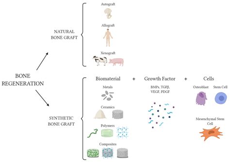 IJMS | Free Full-Text | Strategies for Bone Regeneration: From Graft to ...