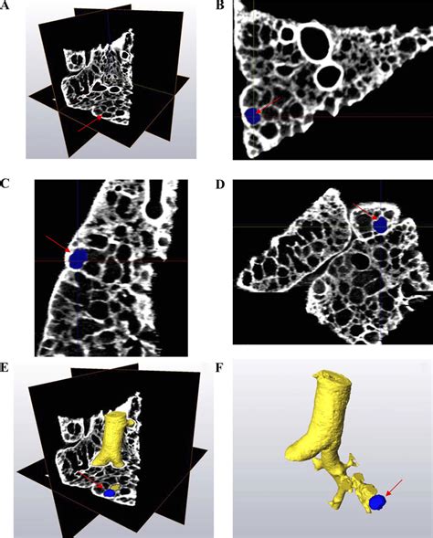 A: 3 orthogonal planes intersecting the 3-dimensional (3D) structure ...