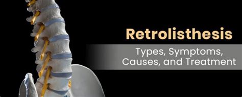 Retrolisthesis: Types, Symptoms, Causes, and Treatment