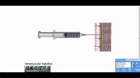 Needle Injections IM Subcutaneous Z Track Intramuscular Procedure Technique Stick - YouTube