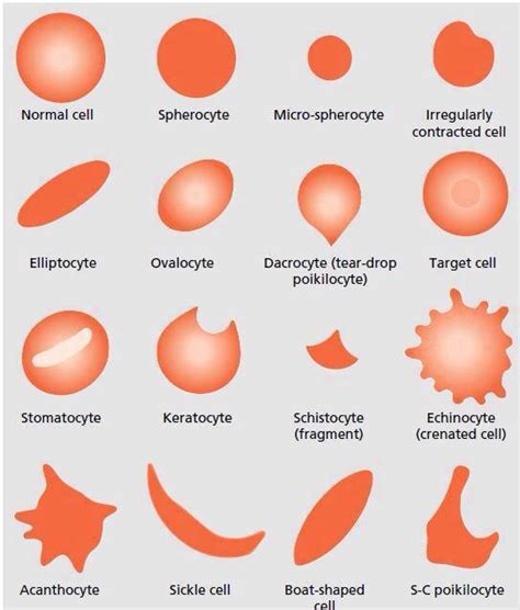 shapes of RBCs | Medical Laboratories