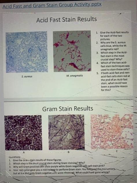 Solved Acid Fast and Gram Stain Group Activity.pptx Acid | Chegg.com