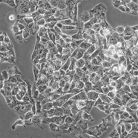 Green Fluorescent HepG2 Cell Line - Innoprot Stable Cell Lines