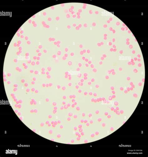 Human blood under the microscope (Blood Smear Human) 400x Stock Photo ...