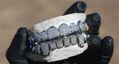 How Much Are Diamond Grillz? - RRP Diamond