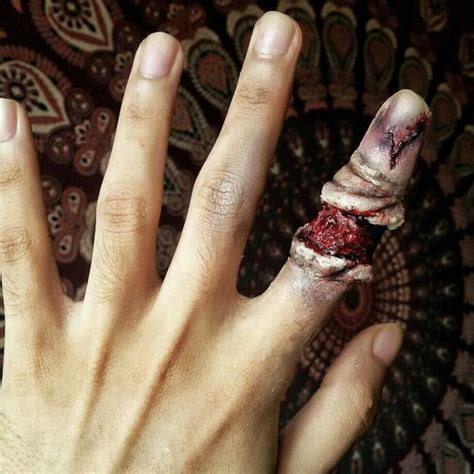 Degloved finger fx | Horror Amino