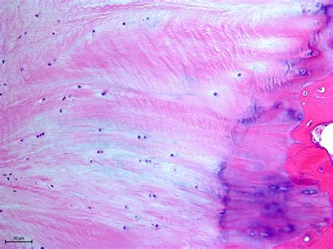 Fibrocartilage Histology