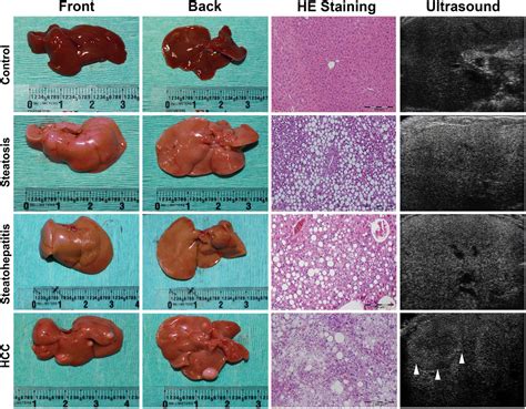 Serological biomarkers associate ultrasound characteristics of steatohepatitis in mice with ...