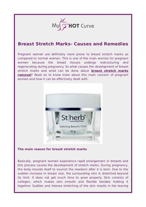 Breast Stretch Marks- Causes and Remedies