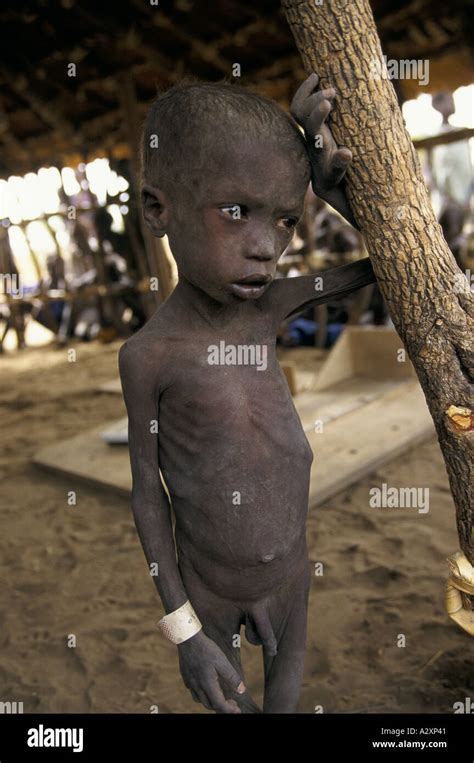 impending famine sudan malnourished child 1998 Stock Photo - Alamy