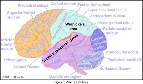 Neuroanatomy Online: Lab 1 - Overview of the Nervous System - Cerebral Lobes - Temporal Lobe ...