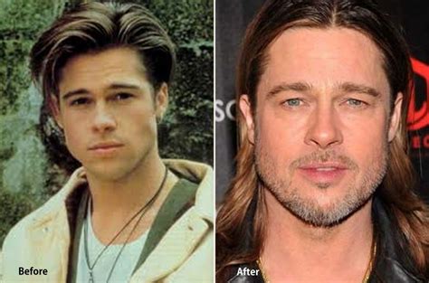 Brad Pitt before and after plastic surgery (21) – Celebrity plastic ...