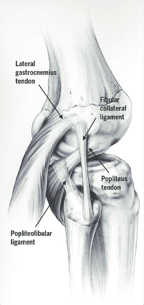 Fibular Collateral Ligament Tear