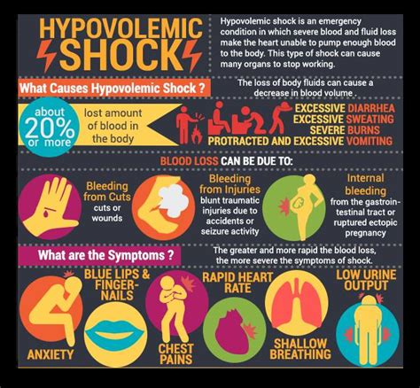 Hypovolemic shock is an emergency condition in which severe blood and fluid loss make the heart ...