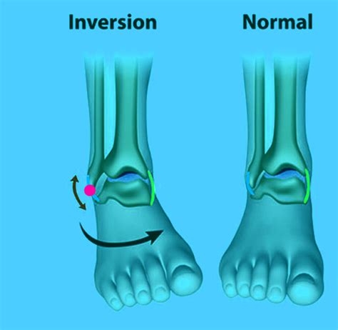 Sports Performance Bulletin - Injuries & health - Ankle injury rehab: should you jump for joy?