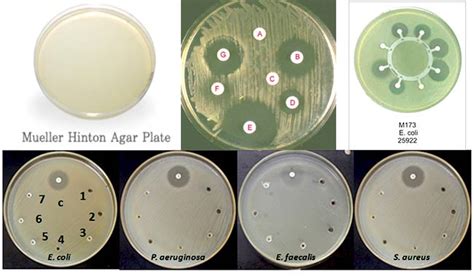 Mueller Hinton Agar (MHA) – Composition, Principle, Uses and Preparation