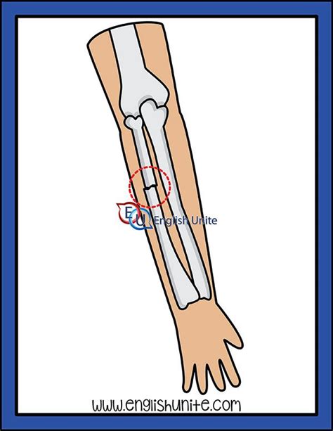 T as Ch - Fracture | Clip art, Single club, Teacher clipart